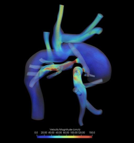 Blood-flow velocity in a three-dimensional cardiovascular simulation